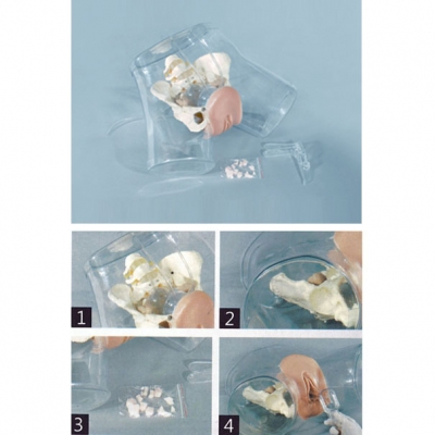 高級透明刮宮醫(yī)學(xué)訓(xùn)練模型