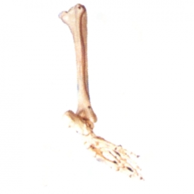 足骨、腓骨和脛骨模型