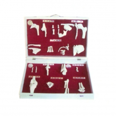 人體骨關節(jié)分類模型