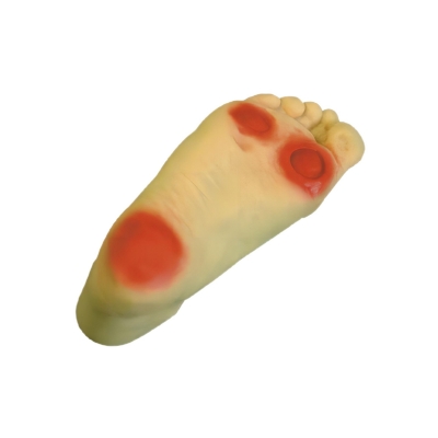 高級(jí)糖尿病足護(hù)理模型