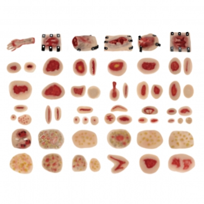 58部件創(chuàng)傷評(píng)估模塊