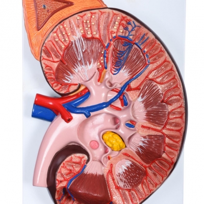 肥大腎模型 